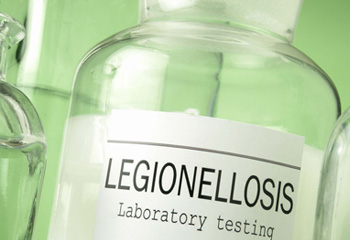 Sample bottle labelled Legionellosis laboratory testing